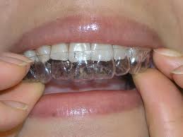 Millions of people have selected Las Vegas Orthodontists to help them get the smile they've always wanted. The right professional will help you achieve a successful treatment outcome and maintain your gorgeous new smile for a lifetime. Orthodontist braces are extremely clever as they do make people's teeth straight without being visible. Click this site https://aloha-orthodontics.com/ for more information on Las Vegas Orthodontists. folow us : https://goo.gl/m75fic
https://goo.gl/9fUUT6
https://goo.gl/FLN1fb
https://goo.gl/QGg1hs
https://goo.gl/Ls5iGX