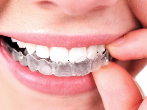 Our website : http://www.aloha-orthodontics.com
Today, consumers can enjoy a fantastic smile easily with professional Las Vegas Invisalign services regardless of where they reside or work. With the professional Invisalign services offered by dental experts in every town, it is common to see visitors from out of town paying a visit to specialists to enjoy the end results. Straight and well aligned teeth can boost the confidence of an individual while crooked or missing teeth can cause stress, low self-confidence and poor self-esteem. A wrong image can be conveyed when one does not smile trying to hide poorly aligned teeth.
My Profile : https://twitter.com/Invisalignz
https://en.gravatar.com/lasvegasprthodontists
https://plus.google.com/u/0/105016626578458307693
