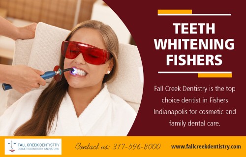 Teeth Whitening Fishers
